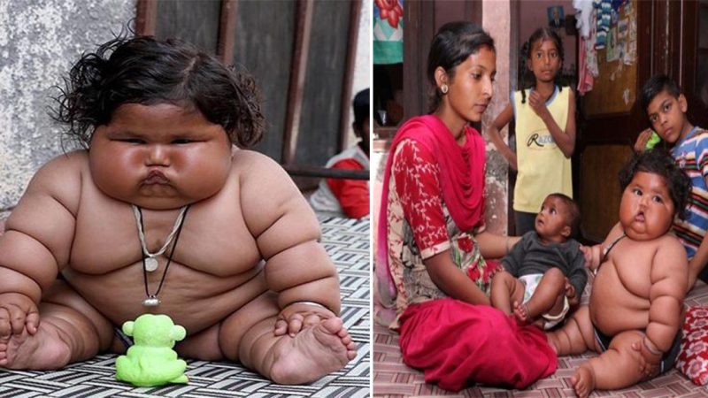 Peculiar Tale Unfolds: Curious Onlookers Perplexed by the Unconventional Life of India’s Heaviest Girl”