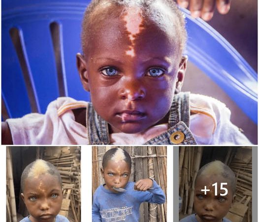 The Extraordinary African Boy with Sapphire Eyes, Ivory Hair, and a Gentle Mark.