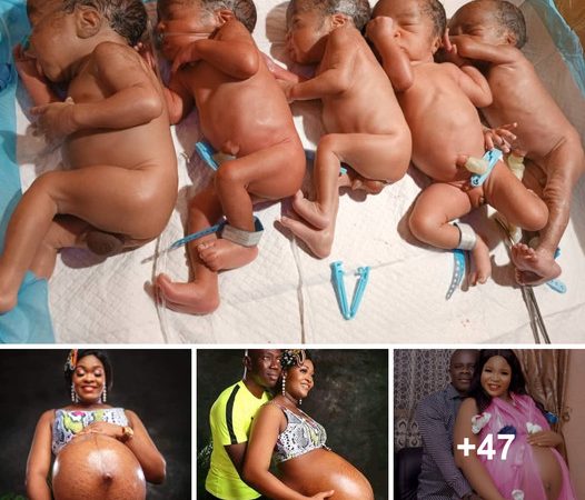 Woman Gives Birth to Quintuplets After 9 Years of Marriage: A Miracle Story