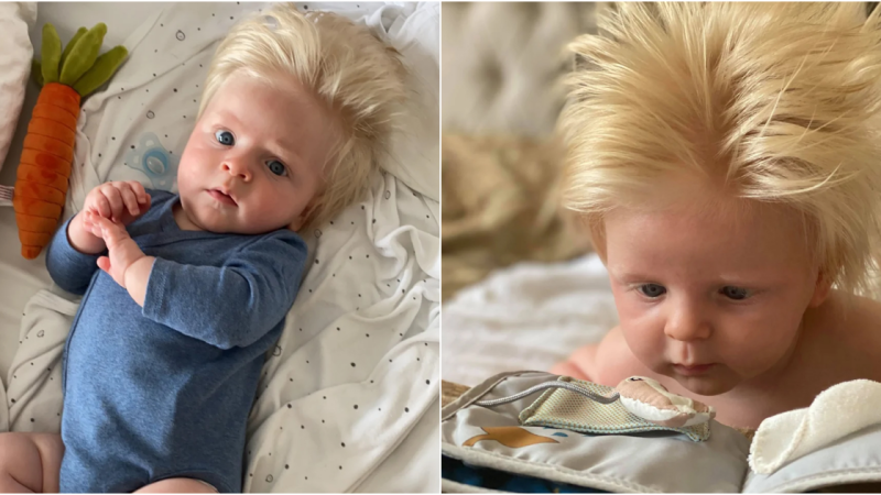 Locks of Gold: The Extraordinary Tale of Baby David’s Unique Mane